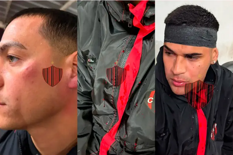  Escándalo en Patronato: Hinchas agredieron a jugadores en la llegada al estadio